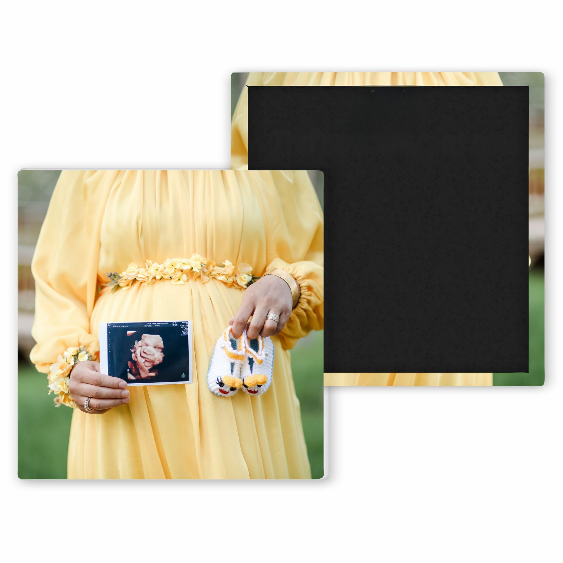 pregnant woman wearing yellow dress holding a sonogram picture and pair of baby booties